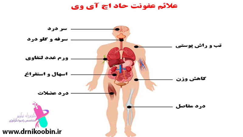 ویروس ایدز