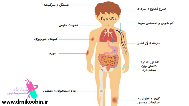 درمان سرطان خون