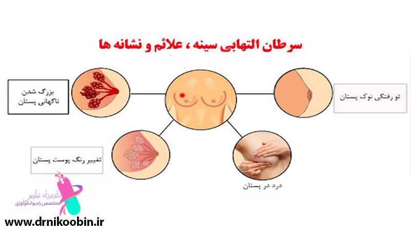 درمان سرطان سینه