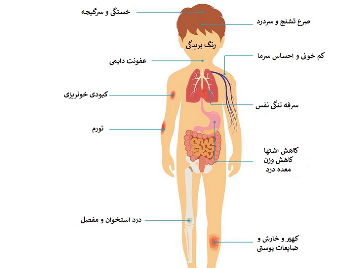 انواع سرطان خون