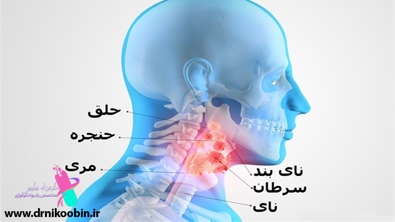 عوارض سرطان و درمان آن