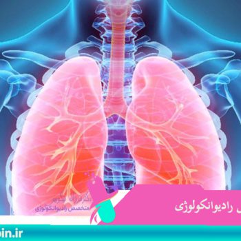 کاهش خطر ابتلا به سرطان ریه