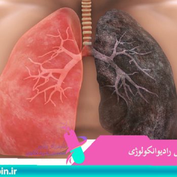 متخصص-رادیوانکولوژی-اصفهان | شیمی-درمانی-اصفهان