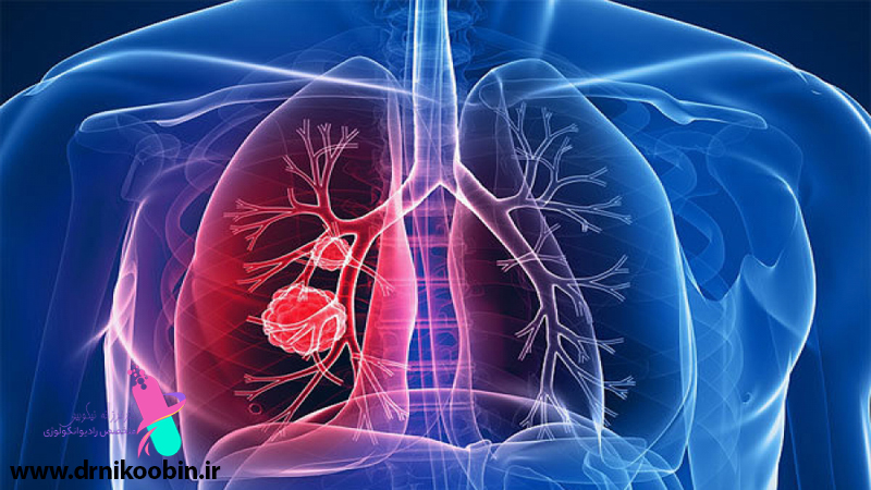 متخصص-رادیوانکولوژی-اصفهان | شیمی-درمانی-اصفهان