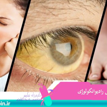 متخصص-رادیوانکولوژی-اصفهان | شیمی-درمانی-اصفهان