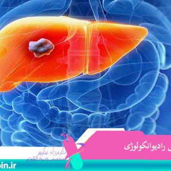 متخصص-رادیوانکولوژی-اصفهان | شیمی-درمانی-اصفهان