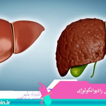 متخصص-رادیوانکولوژی-اصفهان | شیمی-درمانی-اصفهان | دکتر-فرزانه-نیکوبین