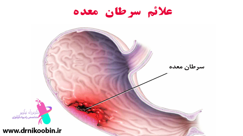 متخصص-رادیوانکولوژی-اصفهان | دکتر-فرزانه-نیکوبین