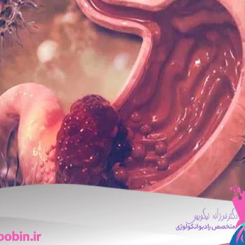 متخصص-رادیوانکولوژی-اصفهان | دکتر-فرزانه-نیکوبین