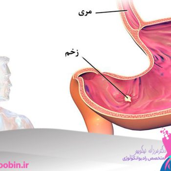 متخصص-رادیوانکولوژی-اصفهان | دکتر-فرزانه-نیکوبین