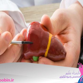 متخصص-رادیوانکولوژی-اصفهان | دکتر-فرزانه-نیکوبین