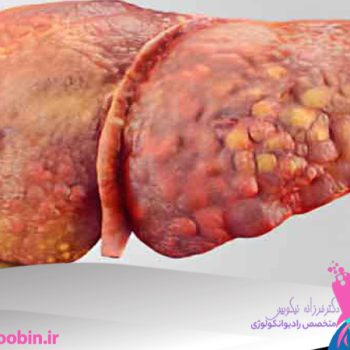 دکتر فرزانه نیکوبین | متخصص رادیوانکولوژی اصفهان | شیمی درمانی اصفهان