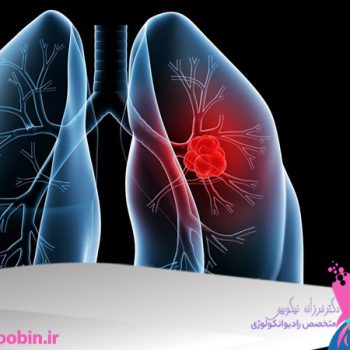 دکتر فرزانه نیکوبین | متخصص رادیوانکولوژی اصفهان | شیمی درمانی اصفهان