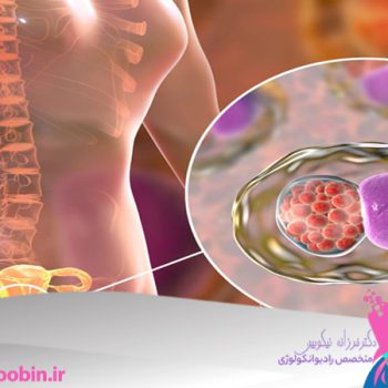 دکتر فرزانه نیکوبین | متخصص رادیوانکولوژی اصفهان | شیمی درمانی اصفهان