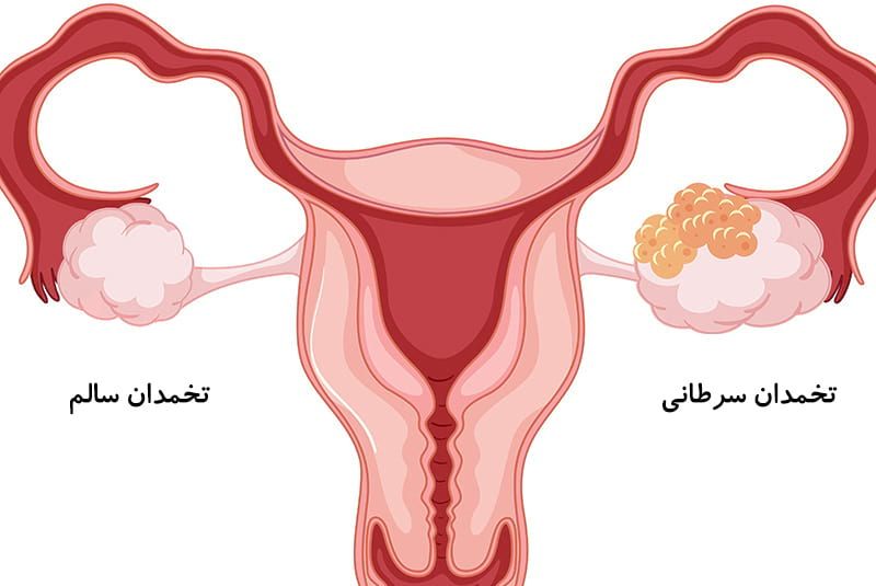 دکتر فرزانه نیکوبین | متخصص رادیوانکولوژی اصفهان | شیمی درمانی اصفهان