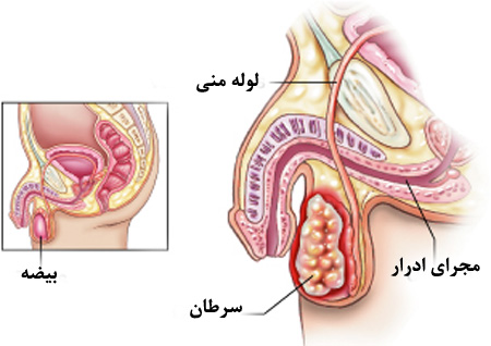 دکتر فرزانه نیکوبین | متخصص رادیوانکولوژی اصفهان | شیمی درمانی اصفهان