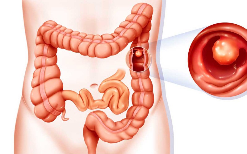 دکتر فرزانه نیکوبین | متخصص رادیوانکولوژی اصفهان | شیمی درمانی اصفهان