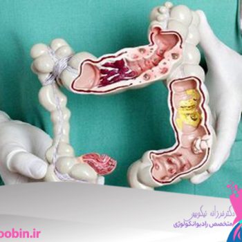 دکتر فرزانه نیکوبین | متخصص رادیوانکولوژی اصفهان | شیمی درمانی اصفهان