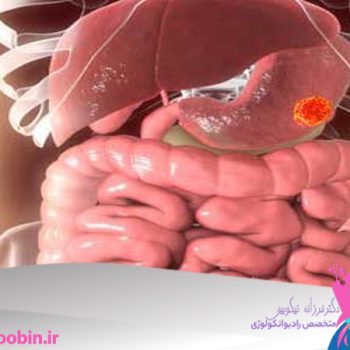 دکتر فرزانه نیکوبین | متخصص رادیوانکولوژی اصفهان | شیمی درمانی اصفهان