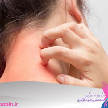 دکتر فرزانه نیکوبین | متخصص رادیوانکولوژی اصفهان | شیمی درمانی اصفهان