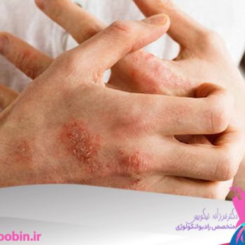 دکتر فرزانه نیکوبین | متخصص رادیوانکولوژی اصفهان | پرتو درمانی اصفهان