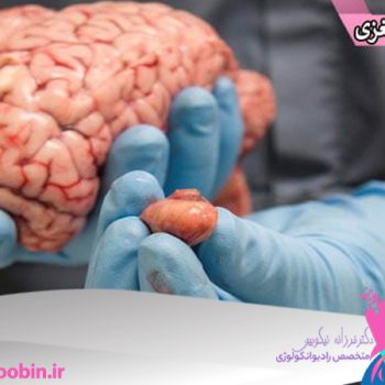 دکتر فرزانه نیکوبین | متخصص رادیوانکولوژی اصفهان | پرتو درمانی اصفهان