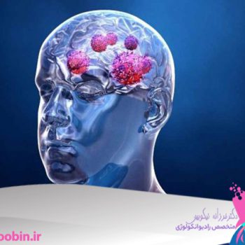 دکتر فرزانه نیکوبین | متخصص رادیوانکولوژی اصفهان | پرتو درمانی اصفهان