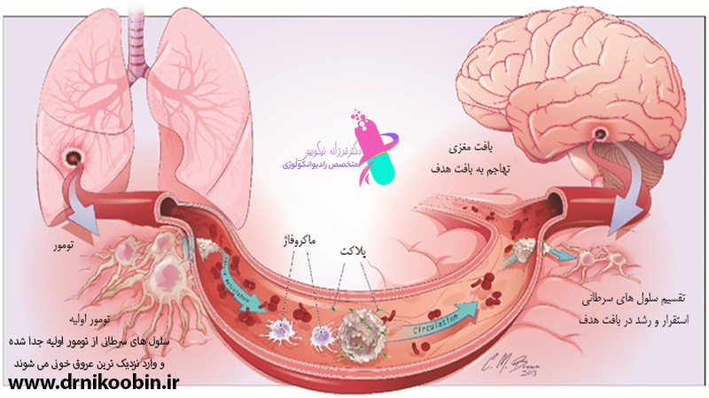 دکتر فرزانه نیکوبین | متخصص رادیوانکولوژی اصفهان | پرتو درمانی اصفهان