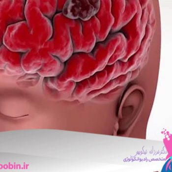 دکتر فرزانه نیکوبین | متخصص رادیوانکولوژی اصفهان | پرتو درمانی اصفهان