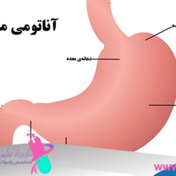 دکتر فرزانه نیکوبین | متخصص رادیوانکولوژی اصفهان | پرتو درمانی اصفهان