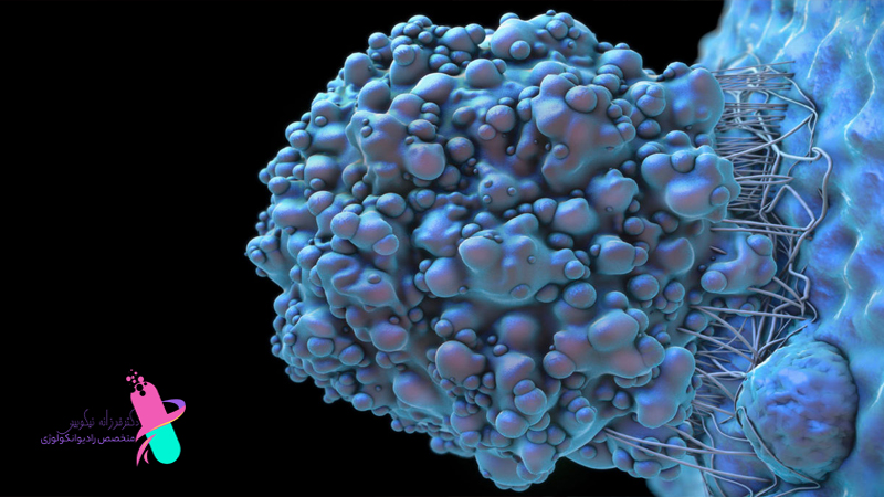 بهترین دکتر سرطان خون در اصفهان | بهترین پزشک بیمارستان میلاد اصفهان