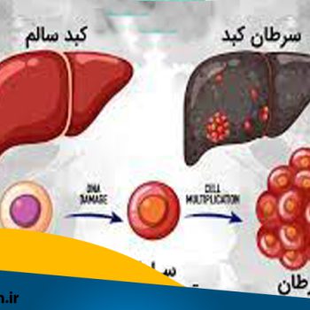 متخصص رادیوانکولوژی اصفهان | متخصص شیمی درمانی اصفهان | دکتر فرزانه نیکوبین