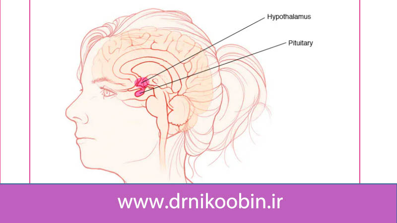 تومورهای غده هیپوفیز