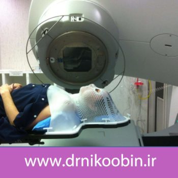 پرتودرمانی برای سرطان حنجره