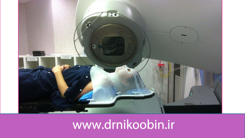 پرتودرمانی برای سرطان حنجره