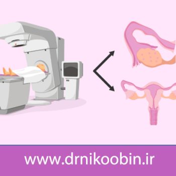 تاثیر پرتودرمانی بر باروری