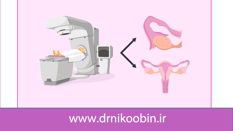 تاثیر پرتودرمانی بر باروری