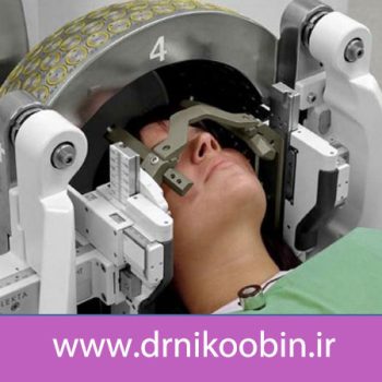 جراحی گاما نایف چیست