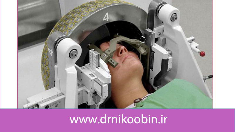 جراحی گاما نایف چیست