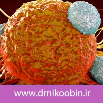 درمان سرطان با پروتون تراپی